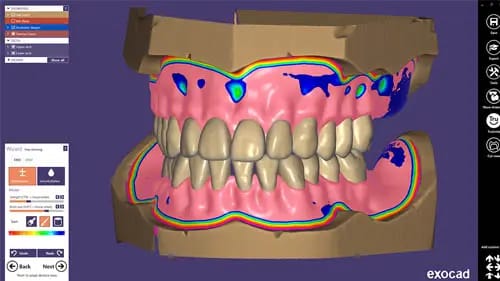 exocad